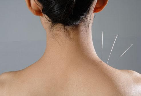 Acupuncture course in chennai